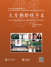 无管胸腔镜手术