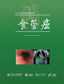食管癌